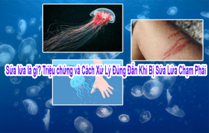 Sứa Lửa – “Kẻ Chạm Nhẹ Gây Rát Bỏng” Mùa Biển Nóng